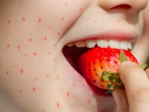 Aardbeienallergie: oorzaken, symptomen en behandeling